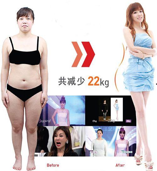 明星做抽脂,揭秘抽脂术的神奇魅力